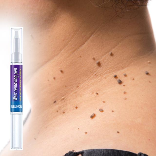 Gadgets d'Eve TAGFREE™ : Stylo Anti-Verrue